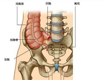 a急性化脓性阑尾炎b急性坏疽性阑尾炎c阑尾炎穿孔